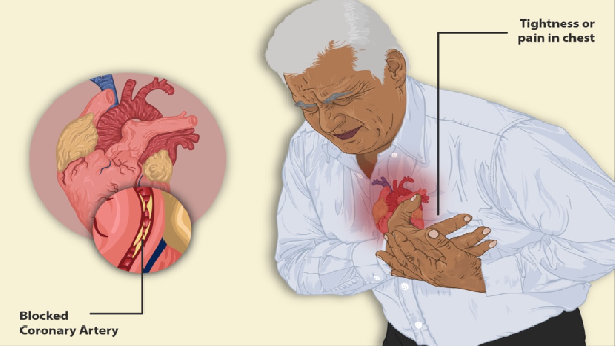 5-tips-to-stop-heart-disease